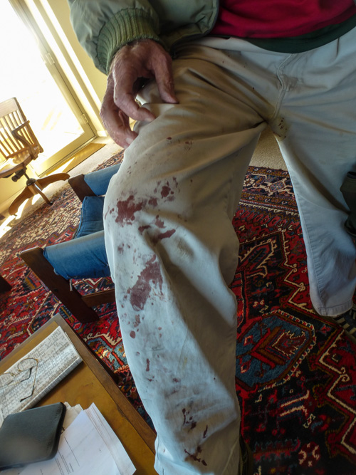 Showing off his bloody britches.