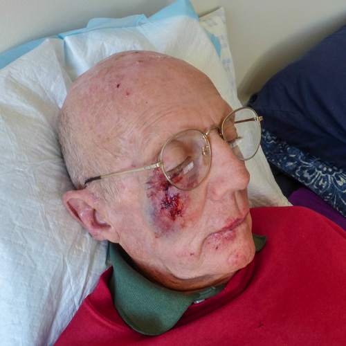 You should see the other guy!