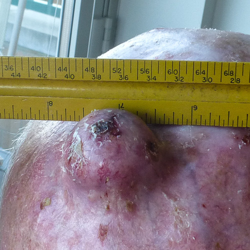 After one week