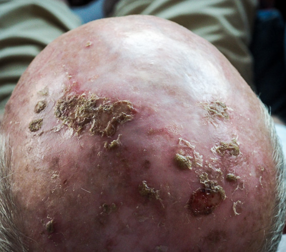 Mr. C's Head